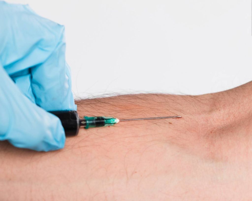 Dysport Injections